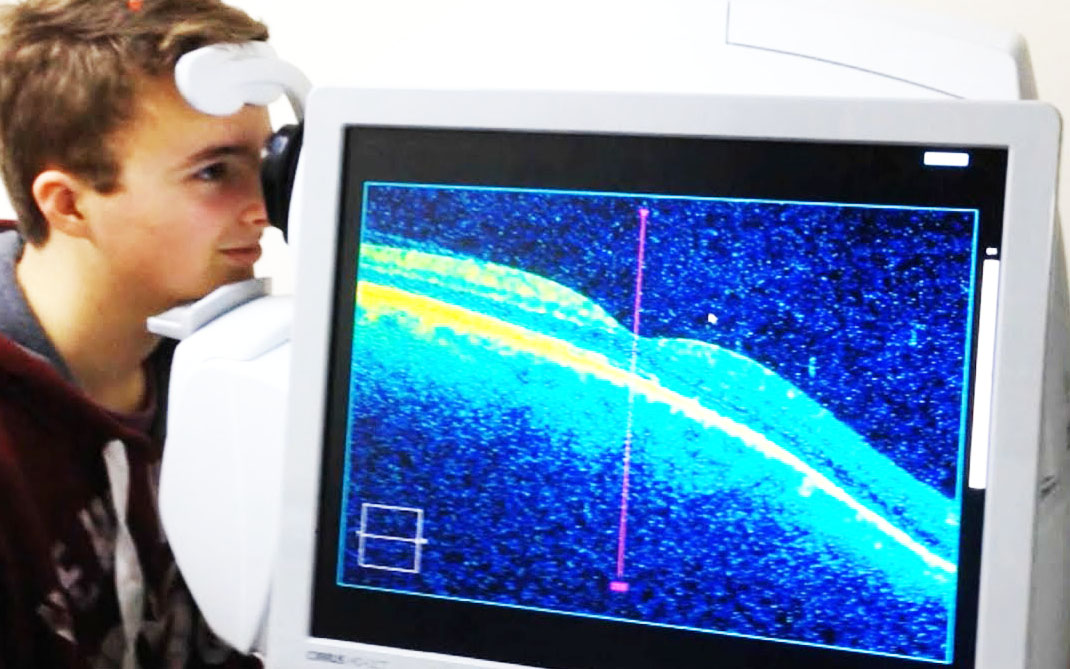 Optical Coherence Tomography Applications